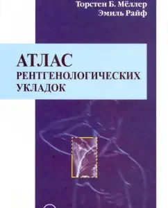 Атлас рентгенологических укладок: Меллер