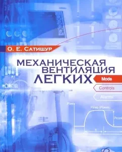 Механическая вентиляция легких: Олег Сатишур